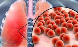 (विश्व निमोनिया दिवस आज) सर्दी की दस्तक और निमोनिया का खतरा- जागरूकता है बचाव (विश्व निमोनिया दिवस आज) सर्दी की दस्तक और निमोनिया का खतरा- जागरूकता है बचाव