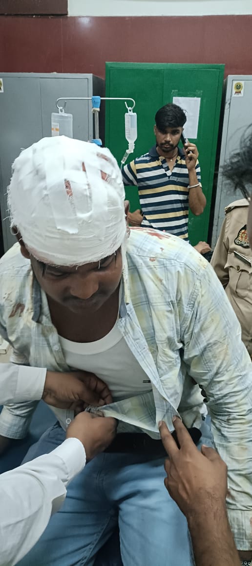 दबंग युवकों ने तबरेज पर किया प्राण घातक हमला, केसदर्ज पुलिस जांच में जुटी दबंग युवकों ने तबरेज पर किया प्राण घातक हमला, केसदर्ज पुलिस जांच में जुटी