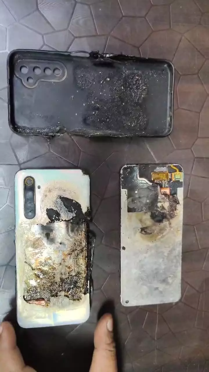 जेब में रखे मोबाइल में विस्फोट से युवक घायल परिवार में दहशत जेब में रखे मोबाइल में विस्फोट से युवक घायल परिवार में दहशत