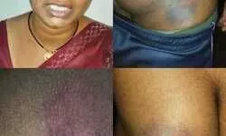 चंदौली पुलिस का अमानवीय चेहरा उजागर: न्याय मांगने पहुंचे युवक की बेल्ट और डंडे से पिटाई का आरोप, वीडियो सोशल मीडिया पर वायरल...