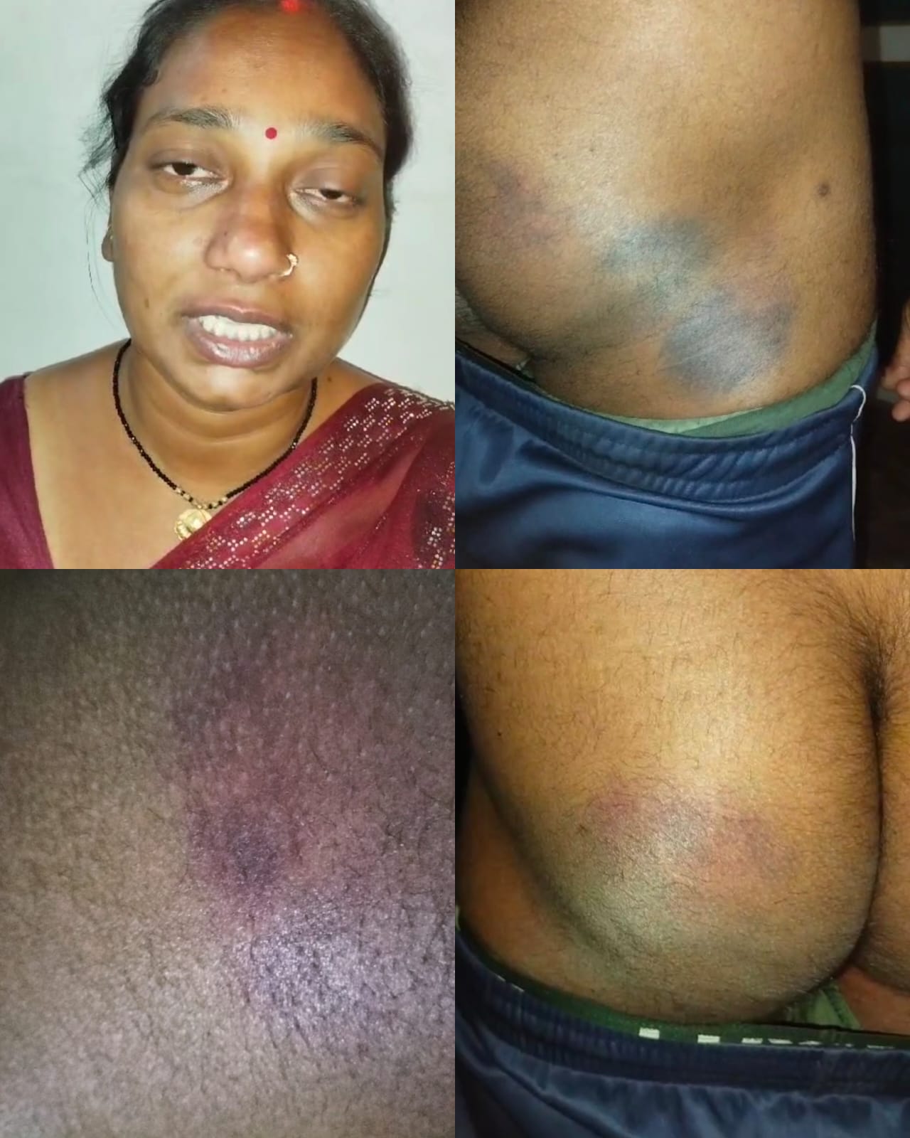 चंदौली पुलिस का अमानवीय चेहरा उजागर: न्याय मांगने पहुंचे युवक की बेल्ट और डंडे से पिटाई का आरोप, वीडियो सोशल मीडिया पर वायरल...