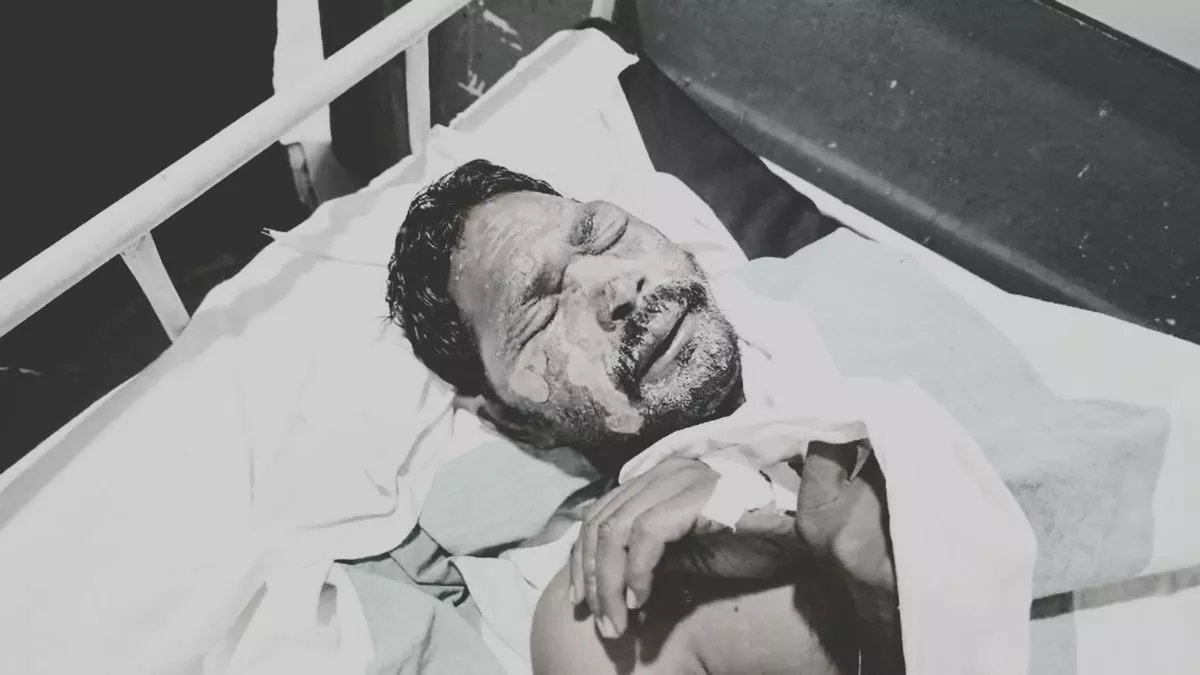 घर में सो रहे पति पर खौलता तेल फेंक कर फरार हुई पत्नी, पहले भी कई बार भाग चुकी है घर में सो रहे पति पर खौलता तेल फेंक कर फरार हुई पत्नी, पहले भी कई बार भाग चुकी है