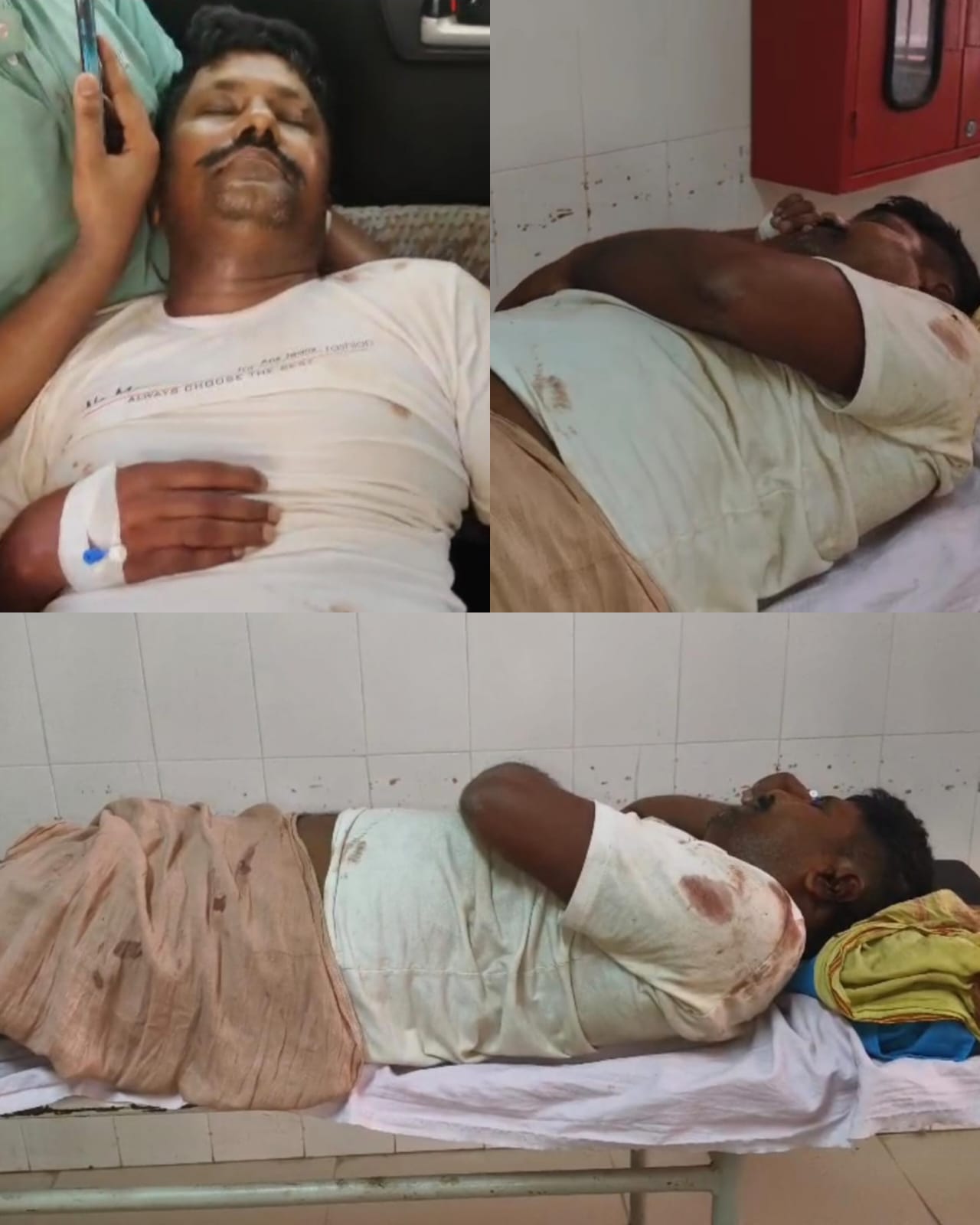 जिम में पानी पीने से शुरू हुआ विवाद बना खूनी संघर्ष, किशोर समेत पिता-पुत्र बुरी तरह घायल जिम में पानी पीने से शुरू हुआ विवाद बना खूनी संघर्ष, किशोर समेत पिता-पुत्र बुरी तरह घायल