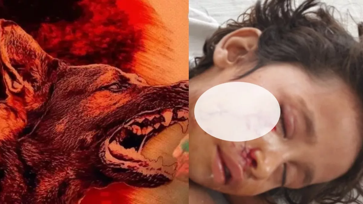 वाराणसी में बच्‍ची के गले को जकड़कर घसीटता रहा कुत्‍ता, लगे 18 टांके तो मुश्‍क‍िल से बची जान