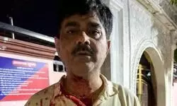 लखनऊ: उपमुख्यमंत्री के कार्यालय के अधिकारी पर जानलेवा हमला लखनऊ: उपमुख्यमंत्री के कार्यालय के अधिकारी पर जानलेवा हमला