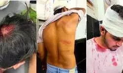 рдЪрд░реНрдЪрд┐рдд рдпреВрдЯреНрдпреВрдмрд░ рдЕрд╢рд╡реА рдпрд╛рджрд╡ рдХреЗ рднрд╛рдИ рдХреЛ рд╕рд░рд┐рдпрд╛,рдзрд╛рд░рджрд╛рд░ рд╣рдерд┐рдпрд╛рд░ рд╕реЗ рдЬрд╛рдирд▓реЗрд╡рд╛ рд╣рдорд▓рд╛ рдХрд░ рдХрд┐рдпрд╛ рдШрд╛рдпрд▓, рд╕рд┐рд░ рдлрд╛реЬрд╛, рдореБрдХрджрдорд╛ рджрд░реНрдЬ рдЪрд░реНрдЪрд┐рдд рдпреВрдЯреНрдпреВрдмрд░ рдЕрд╢рд╡реА рдпрд╛рджрд╡ рдХреЗ рднрд╛рдИ рдХреЛ рд╕рд░рд┐рдпрд╛,рдзрд╛рд░рджрд╛рд░ рд╣рдерд┐рдпрд╛рд░ рд╕реЗ рдЬрд╛рдирд▓реЗрд╡рд╛ рд╣рдорд▓рд╛ рдХрд░ рдХрд┐рдпрд╛ рдШрд╛рдпрд▓, рд╕рд┐рд░ рдлрд╛реЬрд╛, рдореБрдХрджрдорд╛ рджрд░реНрдЬ