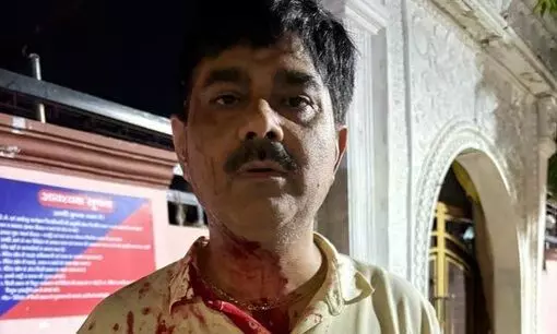 लखनऊ: उपमुख्यमंत्री के कार्यालय के अधिकारी पर जानलेवा हमला लखनऊ: उपमुख्यमंत्री के कार्यालय के अधिकारी पर जानलेवा हमला