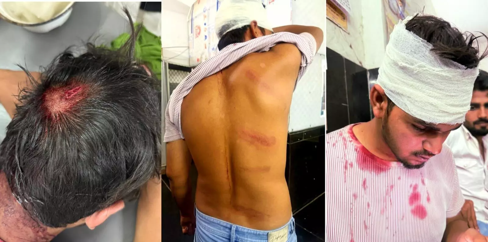 चर्चित यूट्यूबर अशवी यादव के भाई को सरिया,धारदार हथियार से जानलेवा हमला कर किया घायल, सिर फाड़ा, मुकदमा दर्ज चर्चित यूट्यूबर अशवी यादव के भाई को सरिया,धारदार हथियार से जानलेवा हमला कर किया घायल, सिर फाड़ा, मुकदमा दर्ज