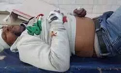 कुत्ता सामने आने से बाइक फिसली, एक गंभीर घायल कुत्ता सामने आने से बाइक फिसली, एक गंभीर घायल