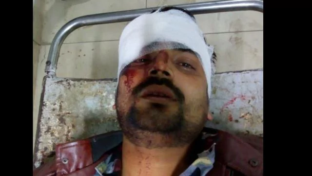 कानपुरः पनकी में देर रात वकील और उसके साथी को गोली मारी