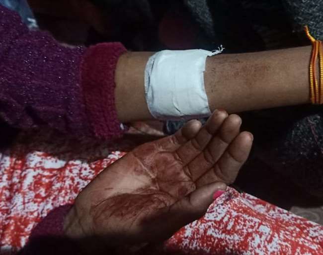 रास्‍ते में छेड़ते थे शोहदे तो स्‍कूल जाना बंद कर दी छात्रा, अब घर में घुसकर मारा चाकू