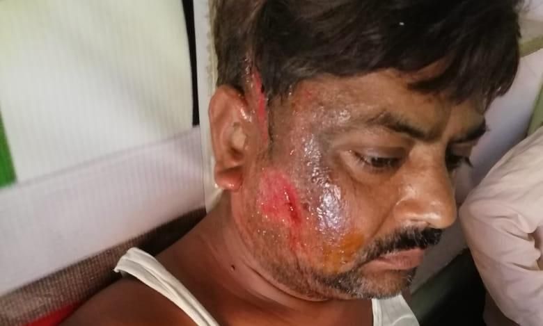 सांड की टक्कर से गंभीर घायल हुआ पत्रकार, राहगीरों ने जैसे-तैसे सांड के चंगुल से बचाया