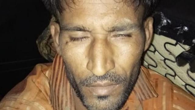 रकबर की मौत चोट से पहुंचे सदमे से हुई- पोस्टमार्टम रिपोर्ट