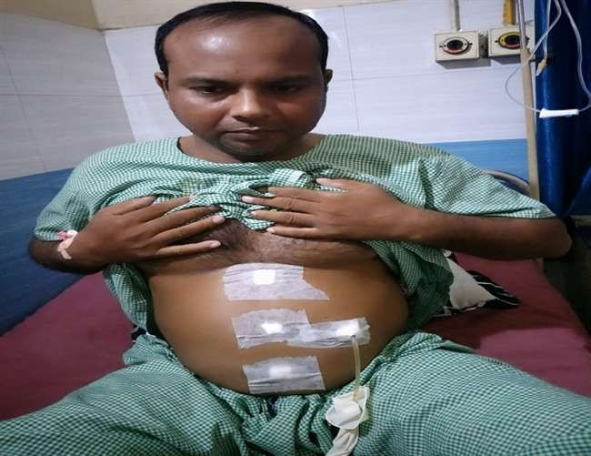 हैरतंगेज: जमालुद्दीन का दिल दाहिनी तरफ और लिवर व गॉल ब्लैडर बाईं तरफ, फिर भी सामान्य हैरतंगेज: जमालुद्दीन का दिल दाहिनी तरफ और लिवर व गॉल ब्लैडर बाईं तरफ, फिर भी सामान्य