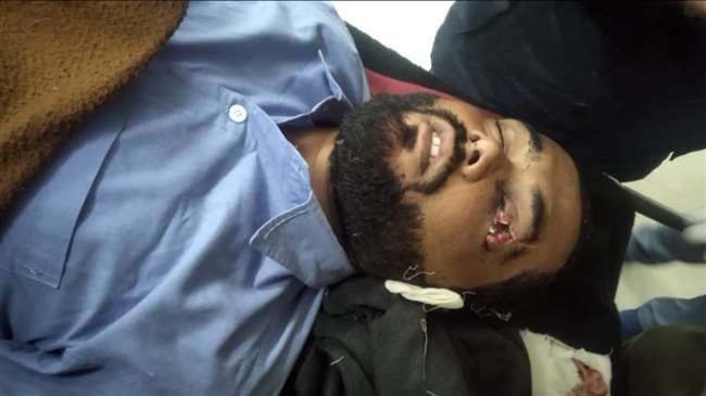 देवरिया में युवक से दरिंदगी- आंख फोड़ी, हालत बिगड़ी