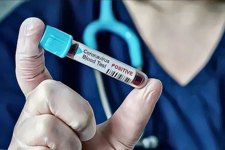 दिल्ली के जामा मस्जिद इलाके में एक ही परिवार के 11 लोग कोरोना से संक्रमित। विदेश से आए शख्स के संपर्क में आए थे।