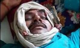 प्रतापगढ़ में लाठी-डंडे और असलहे के बट से प्रधान व महिलाओं पर हमला प्रतापगढ़ में लाठी-डंडे और असलहे के बट से प्रधान व महिलाओं पर हमला