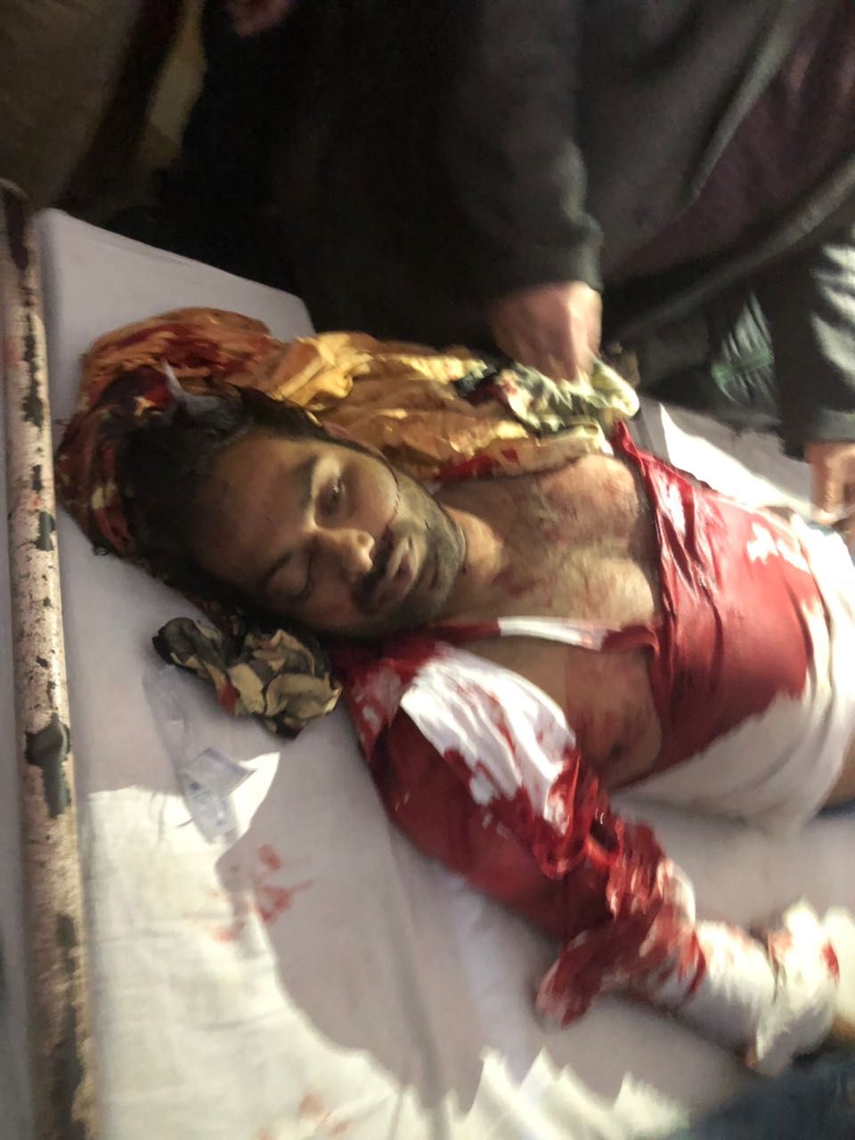 जगदीशपुर/अमेठी-थाना क्षेत्र कस्बा स्थित बिजया बैंक के पास अज्ञात बदमाशों ने मारी गोली।एक की मौके पर मौत,दो की हालत गंभीर।मृतक का नाम असफाक निवासी बड़े गांव।