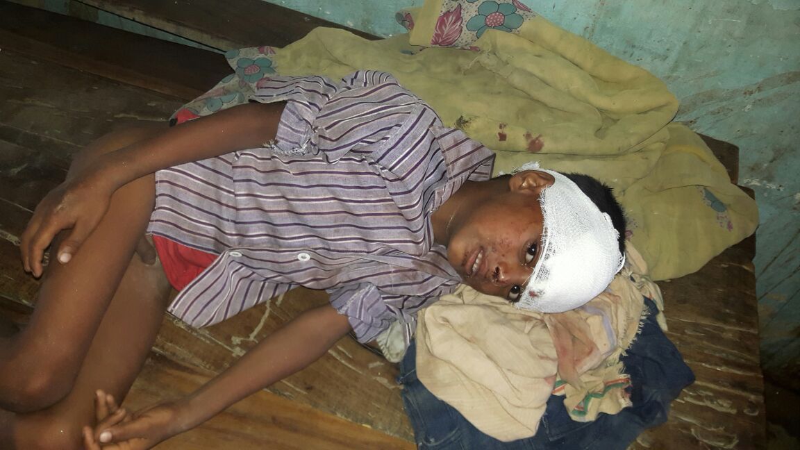 स्कूल की दीवार व छप्पर गिरने से 9 बच्चे घायल स्कूल की दीवार व छप्पर गिरने से 9 बच्चे घायल