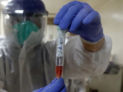 आजमगढ़ : 4 नये कोरोना संक्रमित मरीज मिले जिले में कोरोना संक्रमितों की संख्या 171 पहुची15 मरीज अभी सक्रिय150 मरीज ठीक होकर घर जा चुके6 संक्रमित मरीज की हुई मौत सीएमओ ने की पुष्टि...