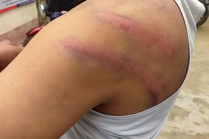 RSS कार्यकर्ता को लॉकअप में दी थर्ड डिग्री, हंगामे के बाद दरोगा समेत 4 सिपाही सस्पेंड RSS कार्यकर्ता को लॉकअप में दी थर्ड डिग्री, हंगामे के बाद दरोगा समेत 4 सिपाही सस्पेंड