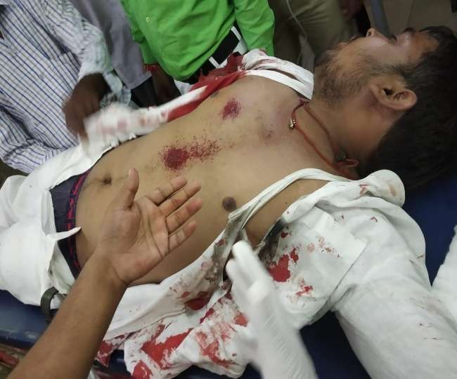 बस्‍ती : एपीएन पीजी कॉलेज छात्र संघ के पूर्व अध्यक्ष को दिनदहाड़े गोली मारी