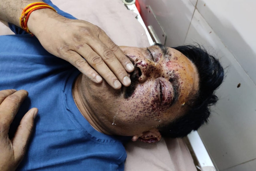 बदमाशों ने SO को मारी गोली, एनकाउंटर में मारा गया आरोपी खनन माफिया पुष्पेंद्र यादव बदमाशों ने SO को मारी गोली, एनकाउंटर में मारा गया आरोपी खनन माफिया पुष्पेंद्र यादव