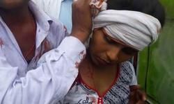 Teachers Day: рд╕реИрдХреЬреЛрдВ рд╢рд┐рдХреНрд╖рдХреЛрдВ рдкрд░ рдпреЛрдЧреА рд╕рд░рдХрд╛рд░ рдХреА рдкреБрд▓рд┐рд╕ рдиреЗ рдмрд░рд╕рд╛рдИ рд▓рд╛рдард┐рдпрд╛рдВ Teachers Day: рд╕реИрдХреЬреЛрдВ рд╢рд┐рдХреНрд╖рдХреЛрдВ рдкрд░ рдпреЛрдЧреА рд╕рд░рдХрд╛рд░ рдХреА рдкреБрд▓рд┐рд╕ рдиреЗ рдмрд░рд╕рд╛рдИ рд▓рд╛рдард┐рдпрд╛рдВ