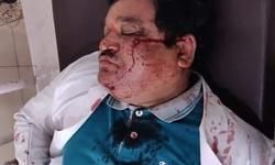 फेंक रहे पत्थर, घायल हो रहे धरती के भगवान : अभय सिंह फेंक रहे पत्थर, घायल हो रहे धरती के भगवान : अभय सिंह