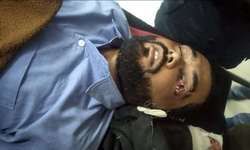 देवरिया में युवक से दरिंदगी- आंख फोड़ी, हालत बिगड़ी