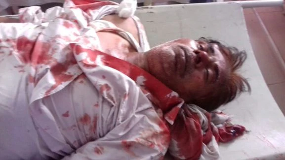 सड़क हादसे में सपा कार्यकर्ता की मौत सड़क हादसे में सपा कार्यकर्ता की मौत