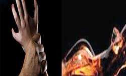 बिहार-सामूहिक दुष्कर्म का विरोध करने पर दरिंदों ने नाबालिग बच्ची को तेजाब से नहलाया