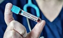 दिल्ली के जामा मस्जिद इलाके में एक ही परिवार के 11 लोग कोरोना से संक्रमित। विदेश से आए शख्स के संपर्क में आए थे।