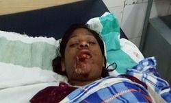 कस्तूरबा गाँधी स्कूल की छात्रा छत से गिरी , गम्भीर रूप से घायल कस्तूरबा गाँधी स्कूल की छात्रा छत से गिरी , गम्भीर रूप से घायल