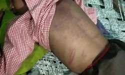 होम वर्क पूरा न होने पर मासूम छात्रा को बेरहमी से पीटा होम वर्क पूरा न होने पर मासूम छात्रा को बेरहमी से पीटा