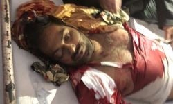 जगदीशपुर/अमेठी-थाना क्षेत्र कस्बा स्थित बिजया बैंक के पास अज्ञात बदमाशों ने मारी गोली।एक की मौके पर मौत,दो की हालत गंभीर।मृतक का नाम असफाक निवासी बड़े गांव।