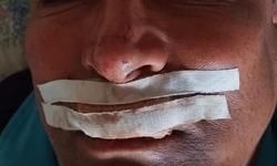 सपा के पूर्व प्रदेश सचिव फिसलकर गिरने से घायल, समर्थक दुखी।