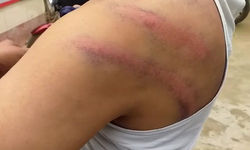 RSS कार्यकर्ता को लॉकअप में दी थर्ड डिग्री, हंगामे के बाद दरोगा समेत 4 सिपाही सस्पेंड RSS कार्यकर्ता को लॉकअप में दी थर्ड डिग्री, हंगामे के बाद दरोगा समेत 4 सिपाही सस्पेंड