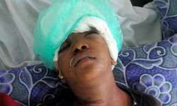 जनरेटर में फंसकर मांस समेत उखड़े बाल, ऑपरेशन में देरी से बच्ची की मौत जनरेटर में फंसकर मांस समेत उखड़े बाल, ऑपरेशन में देरी से बच्ची की मौत