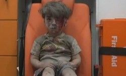 लोगों को भावुक कर रही है सीरिया हमले में घायल हुई बच्‍चे की तस्वीर