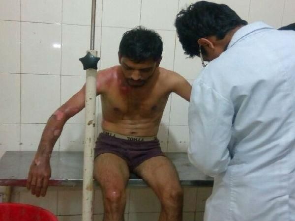 500-1000 के नोट बंद होने की खबर सुनते ही दबंग ने कारीगरों पर पलटी गर्म तेल की कढ़ाई 500-1000 के नोट बंद होने की खबर सुनते ही दबंग ने कारीगरों पर पलटी गर्म तेल की कढ़ाई