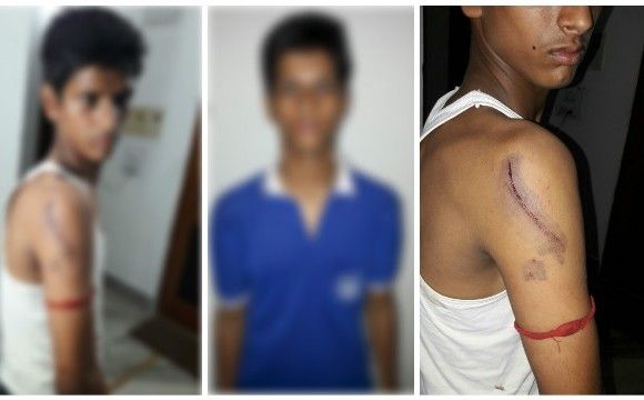 बेरहम टीचर ने की बेकसूर छात्र की बर्बरता से पिटाई बेरहम टीचर ने की बेकसूर छात्र की बर्बरता से पिटाई